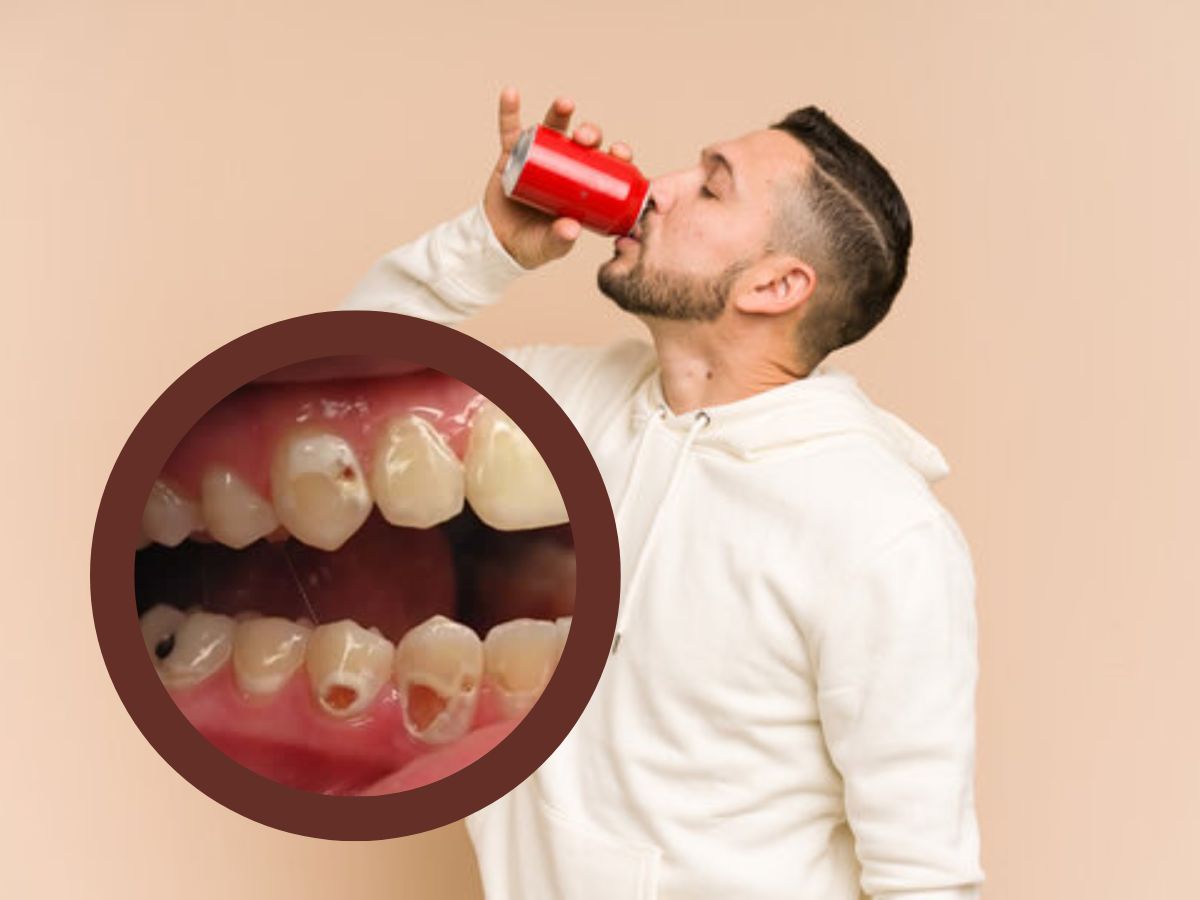 Cold Drink effect on Cold Drink on your teeth